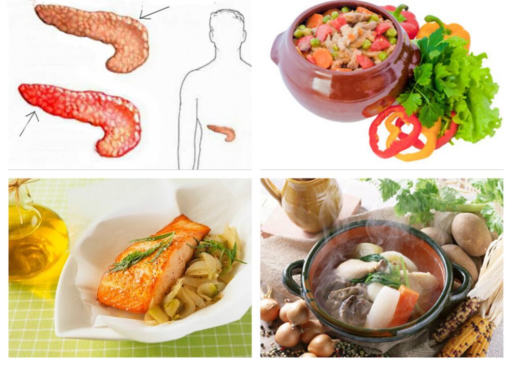 Pancreatitis dietética
